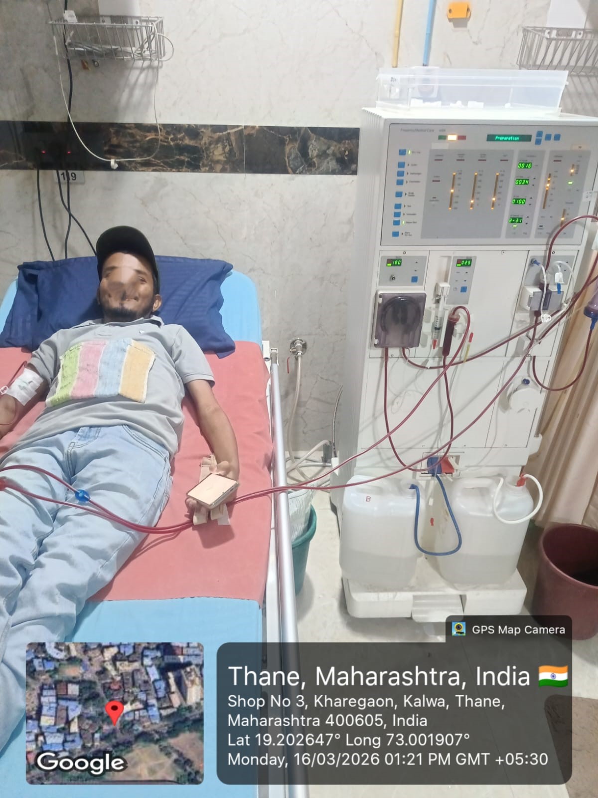 Dialysis 1