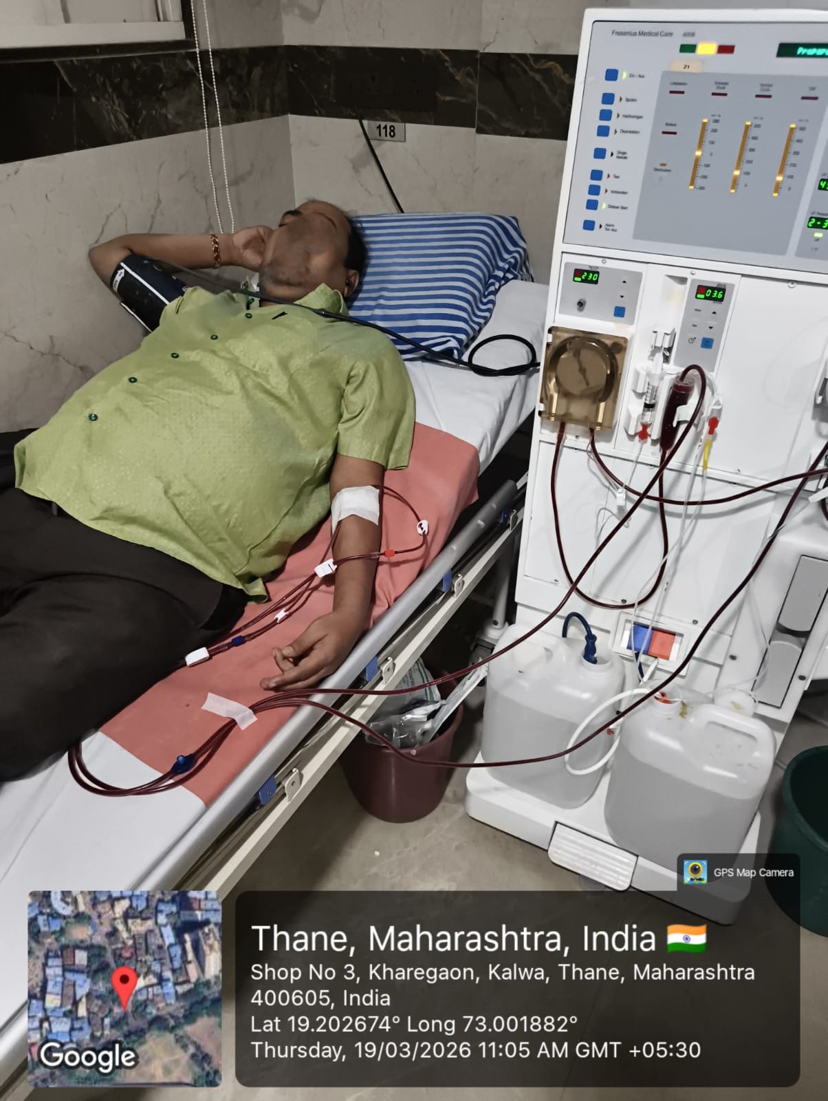 Dialysis 4